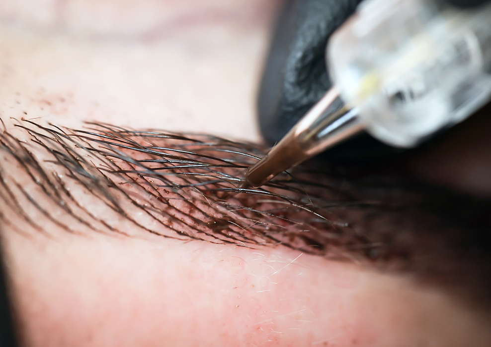 Dermopigmentation exemple 1